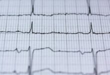 strengthen online lens pulse